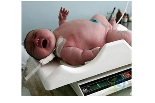 世界上最胖的宝宝在哪里 出生体重高达20斤（吉尼斯纪录）