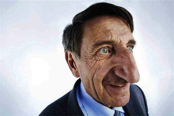 世界上最大鼻子的人是谁 梅赫梅特因为鼻子成为名人