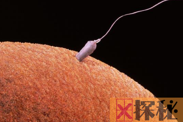 世界上最大的精子:苍蝇精子长6厘米(是身体的10倍)