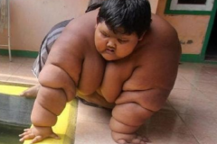 世界上最胖的男孩:5岁后疯狂暴食(12岁长380斤)