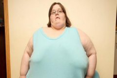 世界第一胖人:最高体重达1454斤(34岁就因病逝世)