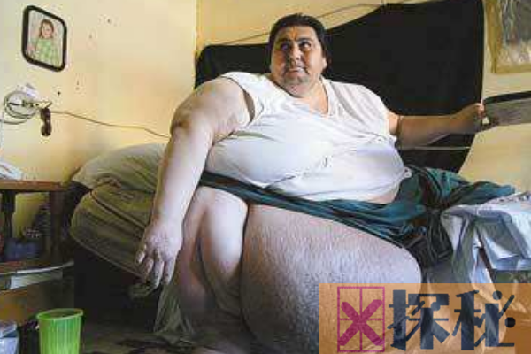 世界上最胖的男人曼努埃尔·乌里韦:重半吨(无法行走)