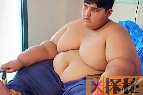 世界上最胖的孩子:10岁就接近400斤(饭量惊人)