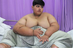 世界上最胖的孩子:10岁就接近400斤(饭量惊人)