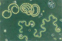 世界上最小的活生物体 古菌微生物（2006年被发现）