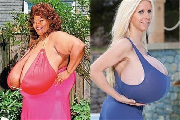 世界上胸最大的女人是谁 安妮·霍金斯特纳（胸重达77斤）