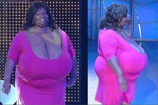 世界上胸最大的女人是谁 安妮·霍金斯特纳（胸重达77斤）