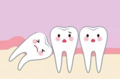 智齿不用拔的三种情况:智齿正常，智齿阻生，智齿没长出