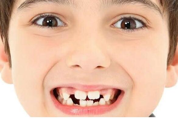 牙齿矫正的最佳时间是什么时候 三个年龄段矫正牙齿最佳