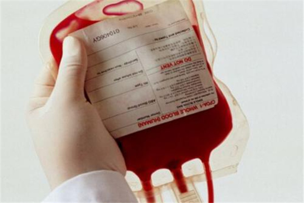 世界上最特别的三种血型：O型血患病率低（Rhnull血万能）