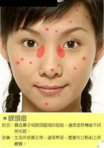 脸部各个部位长痘痘的原因示意图：原因详解(附改善办法)
