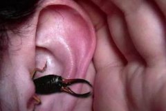 虫子进入耳朵怎么办：往耳朵滴香油或白酒(看医生最好)