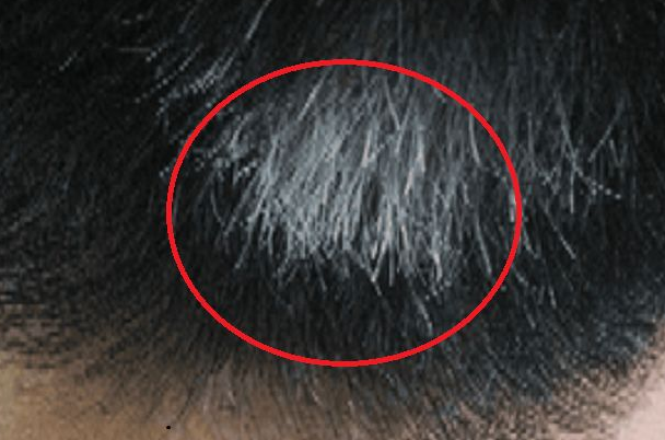 三个部位长白发最危险：两鬓/后脑/脑门(预示身体有问题)