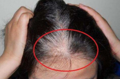 三个部位长白发最危险：两鬓/后脑/脑门(预示身体有问题)