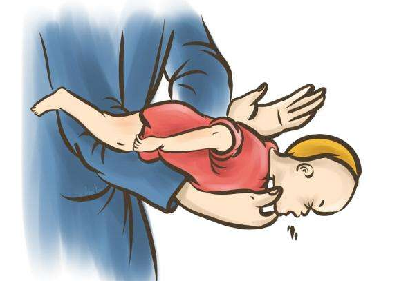 海姆立克急救法三个要点：成人/婴儿/幼儿(动作要领)
